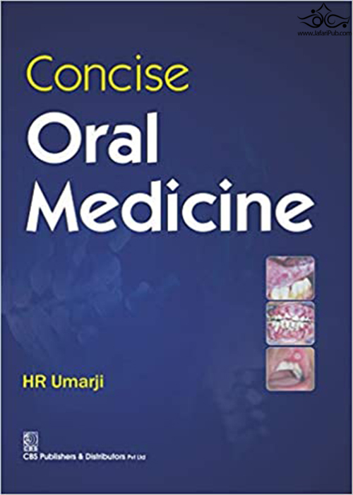 Concise Oral Medicine 2018 CBS Publishers & Distributors