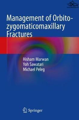 Management of Orbito-zygomaticomaxillary Fractures 2021 Springer