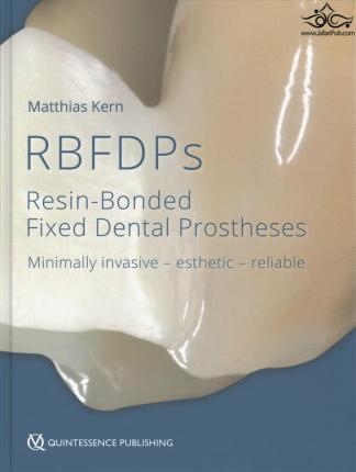 Rbfdps : Resin-Bonded Fixed Dental Prostheses: Minimally Invasive - Esthetic - Reliable  Quintessence Publishing Co Inc.,U.S