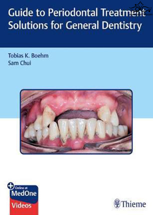 Guide to Periodontal Treatment Solutions for General Dentistry Thieme