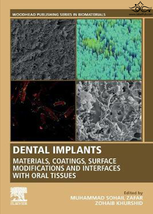 Dental Implants : Materials, Coatings, Surface Modifications and Interfaces with Oral Tissues ELSEVIER