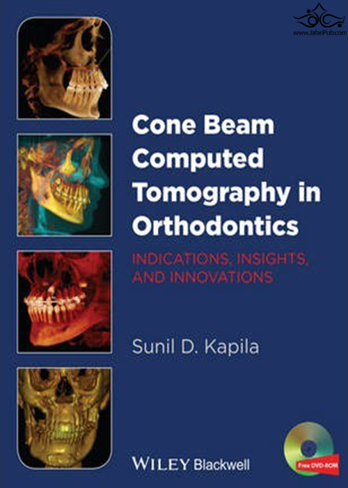 Cone Beam Computed Tomography in Orthodontics : Indications, Insights, and Innovations John Wiley-Sons Inc