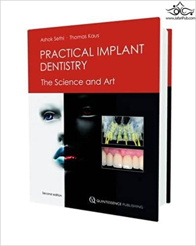 Practical Implant Dentistry: The Science and Art Second Edition Edición  Quintessence Publishing Co Inc.,U.S