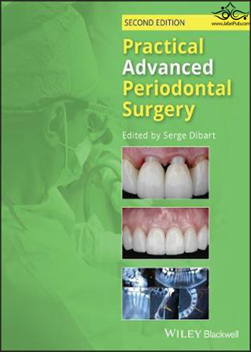 Practical Advanced Periodontal Surgery 2020  John Wiley and Sons Ltd 