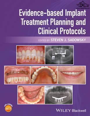 Evidence-based Implant Treatment Planning and Clinical Protocols  John Wiley and Sons Ltd 