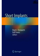 Short Implants | ایمپلنت های کوتاه