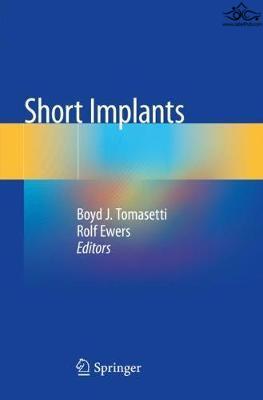 Short Implants Springer