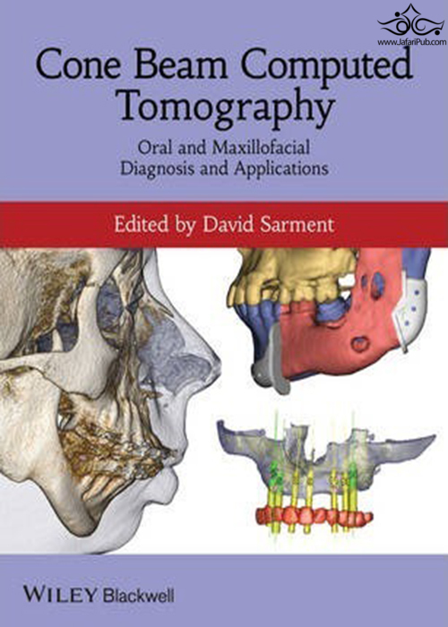 Cone Beam Computed Tomography : Oral and Maxillofacial Diagnosis and Applications John Wiley-Sons Inc