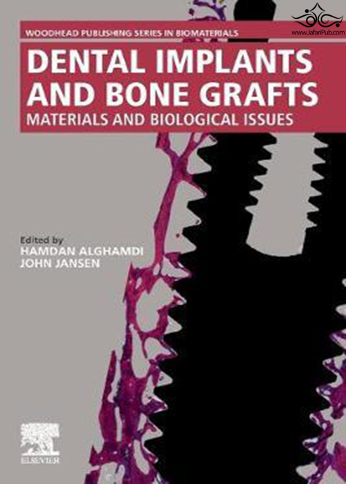Dental Implants and Bone Grafts : Materials and Biological Issues ELSEVIER