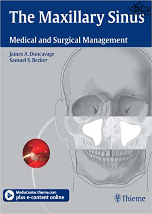 The Maxillary Sinus : Medical and Surgical Management Thieme