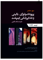 مرور جامع پریودنتولوژی بالینی و دندانپزشکی ایمپلنت لینده 2022