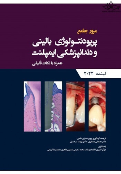 مرور جامع پریودنتولوژی بالینی و دندانپزشکی ایمپلنت لینده 2022