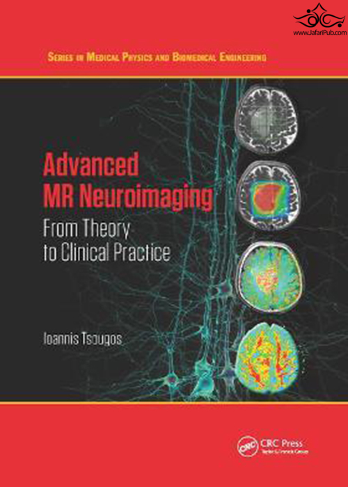 Advanced MR Neuroimaging: From Theory to Clinical Practice (Series in Medical Physics and Biomedical Engineering) 1st Edición Taylor & Francis Ltd