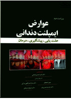 عوارض ایمپلنت دندانی