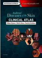 Andrews' Diseases of the Skin Clinical Atlas 1st Edición | اطلس بالینی اندروز بیماری های پوست