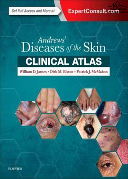 Andrews