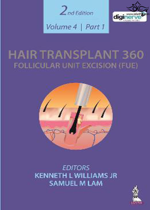 Hair Transplant 360: Follicular Unit Excision (FUE) : Volume 4: Two Part Set  Jaypee Brothers Medical Publishers 