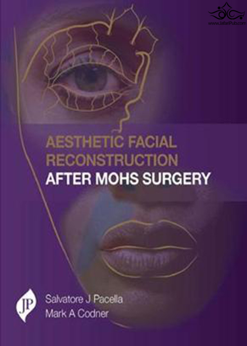 Aesthetic Facial Reconstruction After Mohs Surgery JP Medical Ltd