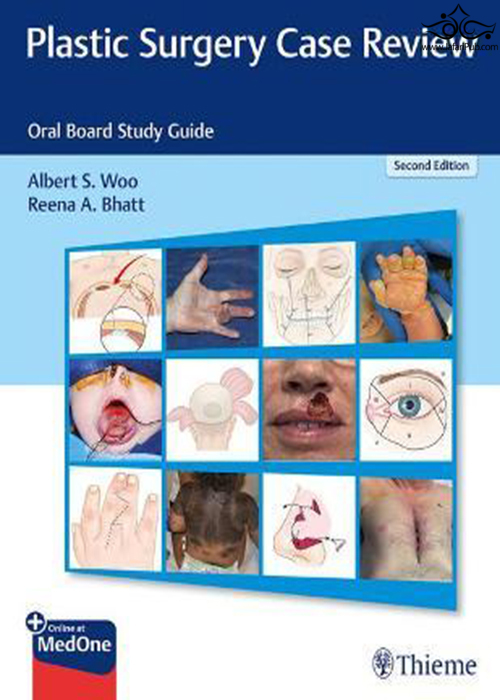 Plastic Surgery Case Review: Oral Board Study Guide 2nd Edición Thieme