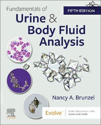 Fundamentals of Urine and Body Fluid Analysis ELSEVIER