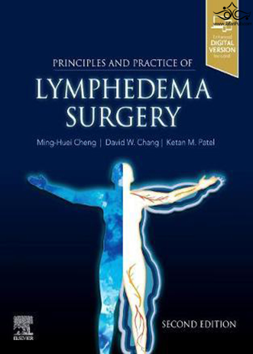 Principles and Practice of Lymphedema Surgery 2nd Edición ELSEVIER