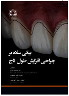 بیانی ساده بر جراحی افزایش طول تاج