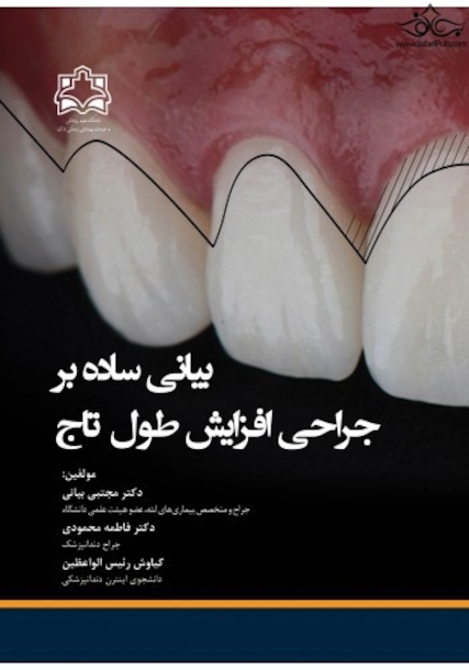 بیانی ساده بر جراحی افزایش طول تاج