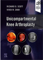 Unicompartmental Knee Arthroplasty | آرتروپلاستی تک بخش زانو 2023