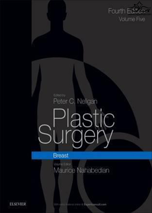 Plastic Surgery Volume 5: Breast 4th Edición ELSEVIER