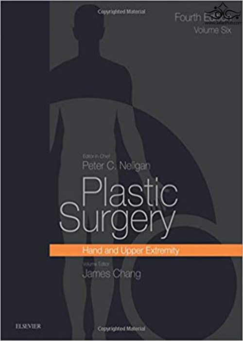 Plastic Surgery Volume 6: Hand and Upper Limb 4th Edición ELSEVIER