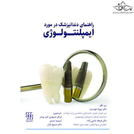 راهنمای دندانپزشک در مورد ایمپلنتولوژی
