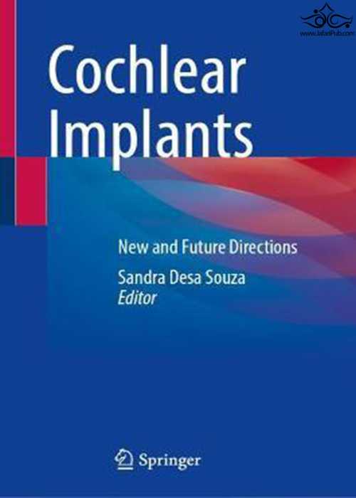 Cochlear Implants: New and Future Directions 1st ed. 2022 Edición Springer