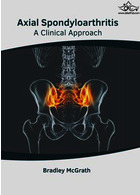 Axial Spondyloarthritis: A Clinical Approach | اسپوندیلوآرتریت محوری