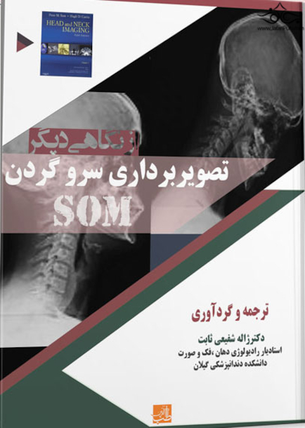 از نگاهی دیگر تصویر برداری سر و گردن som