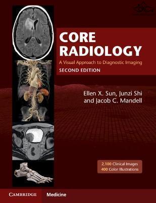 Core Radiology: A Visual Approach to Diagnostic Imaging 2nd Edición Cambridge University Press
