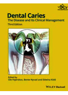 Dental Caries: The Disease and its Clinical Management 3rd Edición | پوسیدگی دندان