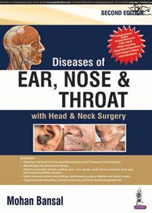Diseases of Ear, Nose and Throat: with Head & Neck Surgery  Jaypee Brothers Medical Publishers 