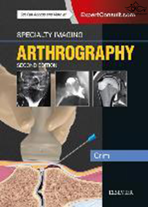Specialty Imaging: Arthrography 2nd Edición ELSEVIER