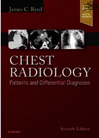 Chest Radiology : Patterns and Differential Diagnoses | رادیولوژی قفسه سینه