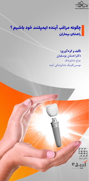 چگونه مراقب آینده ایمپلنت خود باشیم؟