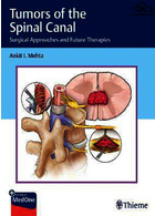 Tumors of the Spinal Canal: Surgical Approaches and Future Therapies 1st Edición | تومورهای کانال نخاعی