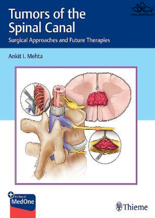 Tumors of the Spinal Canal: Surgical Approaches and Future Therapies 1st Edición Thieme