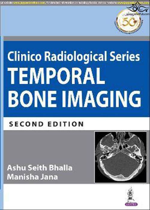 Clinico Radiological Series: Temporal Bone Imaging  Jaypee Brothers Medical Publishers 