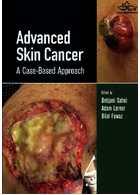 Advanced Skin Cancer: A Case-Based Approach | سرطان پوست پیشرفته