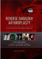 Reverse Shoulder Arthroplasty : A Comprehensive Case-Based Approach | آرتروپلاستی شانه معکوس