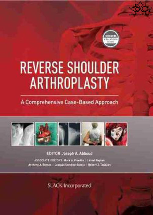 Reverse Shoulder Arthroplasty : A Comprehensive Case-Based Approach  SLACK Incorporated