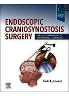 Endoscopic Craniosynostosis Surgery : An Illustrated Guide to Endoscopic Techniques | جراحی آندوسکوپی کرانیوسینوستوز