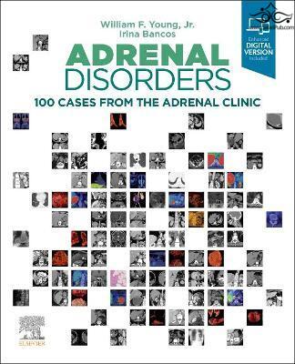 Adrenal Disorders : 100 Cases from the Adrenal Clinic ELSEVIER