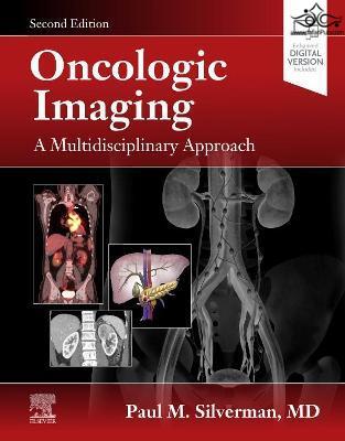 Oncologic Imaging: A Multidisciplinary Approach 2nd Edición ELSEVIER