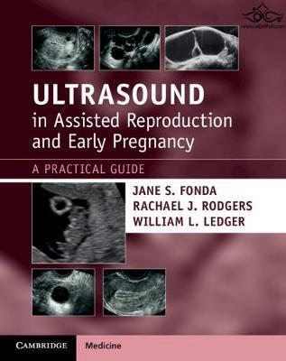 Ultrasound in Assisted Reproduction and Early Pregnancy: A Practical Guide 1st Edición Cambridge University Press